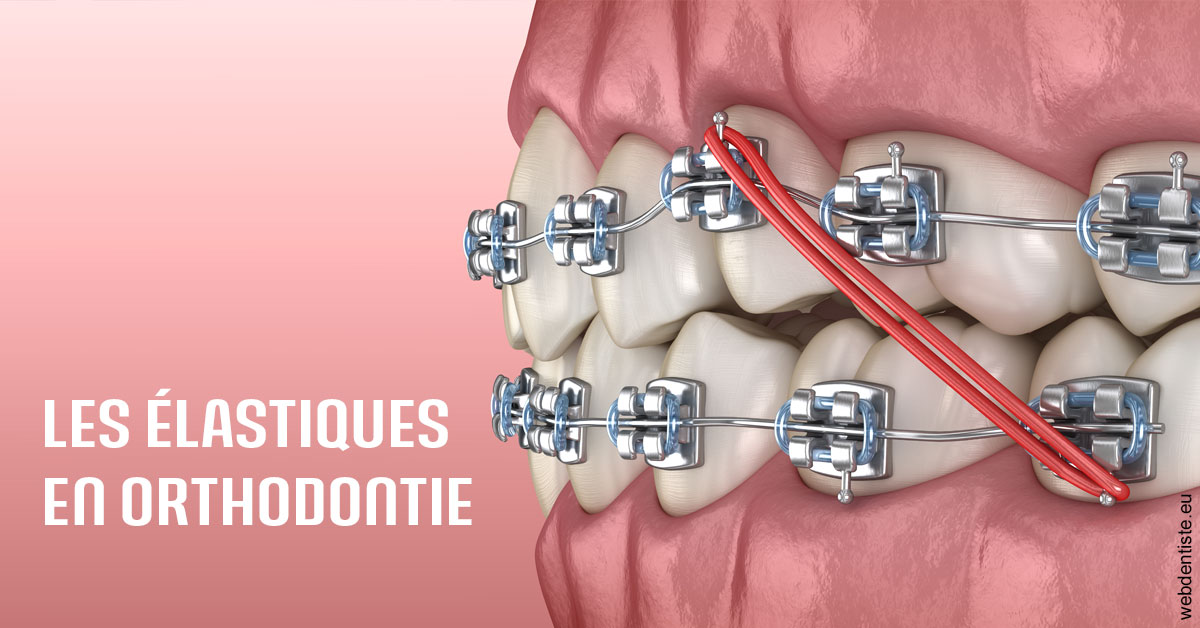 https://www.dralielhusseini.com/Elastiques orthodontie 2